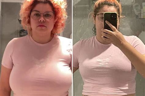 36l boobs|Woman with size P boobs needs £8k for breast reduction after。